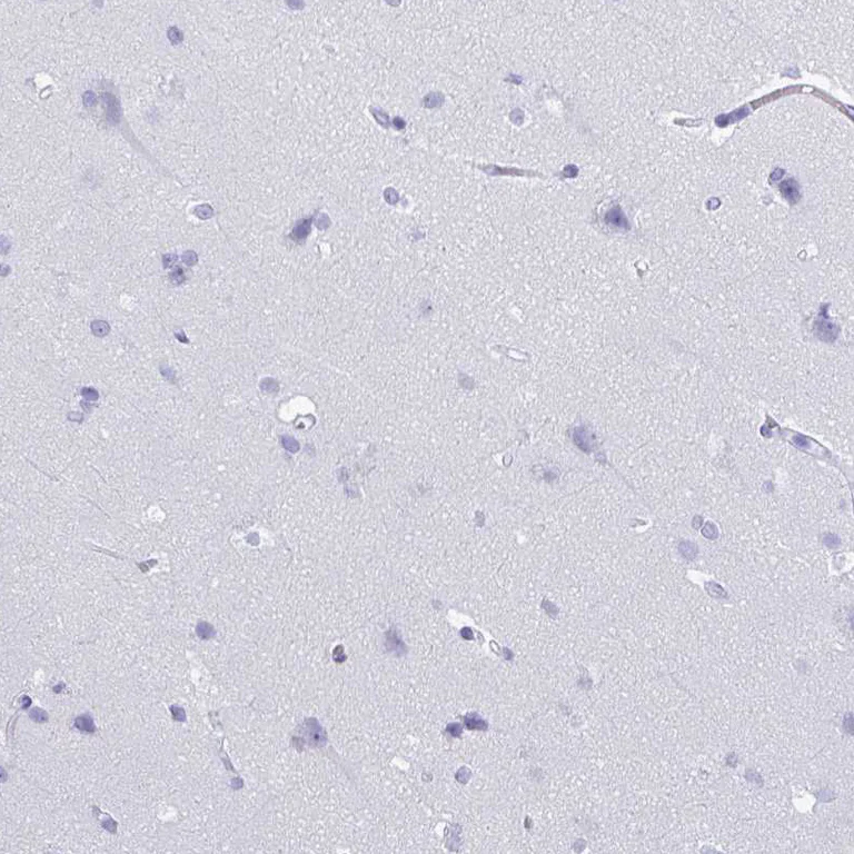 Immunohistochemistry (Formalin/PFA-fixed paraffin-embedded sections) - Anti-CRYBB2 antibody (AB252971)