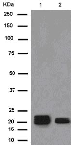Western blot - Anti-CRYGA antibody [EPR13123] (AB181057), expandable thumbnail