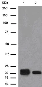 Western blot - Anti-CRYGA antibody [EPR13123] - BSA and Azide free (AB250314)