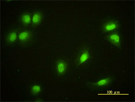 Immunocytochemistry/ Immunofluorescence - Anti-Cryptochrome I/CRY1 antibody [4H4-1C4] (AB54649), expandable thumbnail