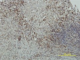 Immunohistochemistry (Formalin/PFA-fixed paraffin-embedded sections) - Anti-Cryptochrome I/CRY1 antibody [4H4-1C4] (AB54649), expandable thumbnail