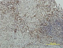 Immunohistochemistry (Formalin/PFA-fixed paraffin-embedded sections) - Anti-Cryptochrome I/CRY1 antibody [4H4-1C4] (AB54649)