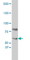 Western blot - Anti-Cryptochrome I/CRY1 antibody [4H4-1C4] (AB54649), expandable thumbnail
