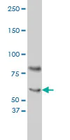 Western blot - Anti-Cryptochrome I/CRY1 antibody [4H4-1C4] (AB54649)