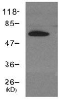 Western blot - Anti-Cryptochrome I/CRY1 antibody (AB104736), expandable thumbnail