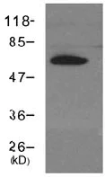 Western blot - Anti-Cryptochrome I/CRY1 antibody (AB104736)