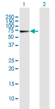 Western blot - Anti-Cryptochrome I/CRY1 antibody (AB171860), expandable thumbnail