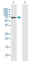 Western blot - Anti-Cryptochrome I/CRY1 antibody (AB171860)