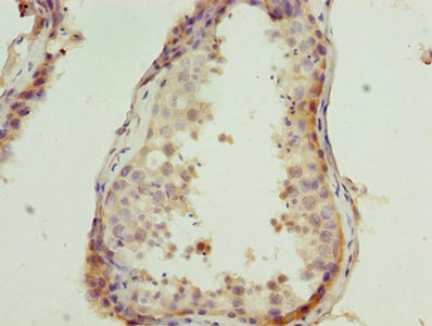 Immunohistochemistry (Formalin/PFA-fixed paraffin-embedded sections) - Anti-CSAG1 antibody (AB238872)