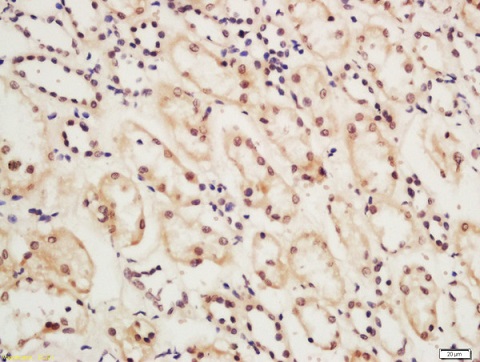 Immunohistochemistry (Formalin/PFA-fixed paraffin-embedded sections) - Anti-CSB antibody (AB217202)