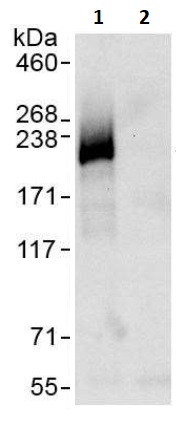 Immunoprecipitation - Anti-CSB antibody (AB264199)