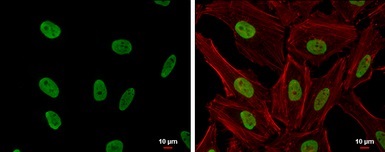 Immunocytochemistry/ Immunofluorescence - Anti-CSB antibody (AB96089)