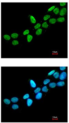 Immunocytochemistry/ Immunofluorescence - Anti-CSB antibody (AB96089), expandable thumbnail