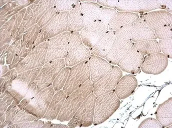 Immunohistochemistry (Formalin/PFA-fixed paraffin-embedded sections) - Anti-CSB antibody (AB96089)