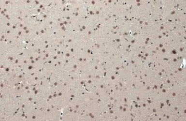 Immunohistochemistry (Formalin/PFA-fixed paraffin-embedded sections) - Anti-CSB antibody (AB96089)