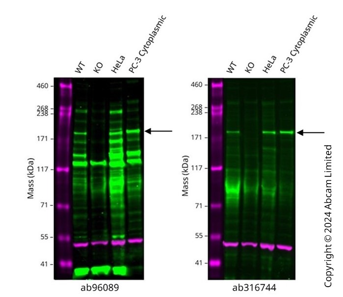Western blot - Anti-CSB antibody (AB96089), expandable thumbnail