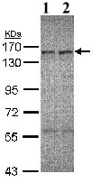 Western blot - Anti-CSB antibody (AB96089), expandable thumbnail