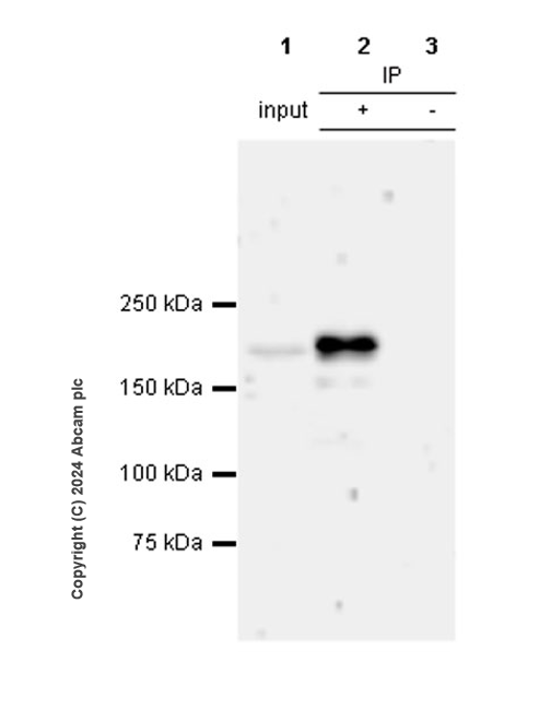 Immunoprecipitation - Anti-CSB antibody [EPR27019-44] - BSA and Azide free (AB316745), expandable thumbnail