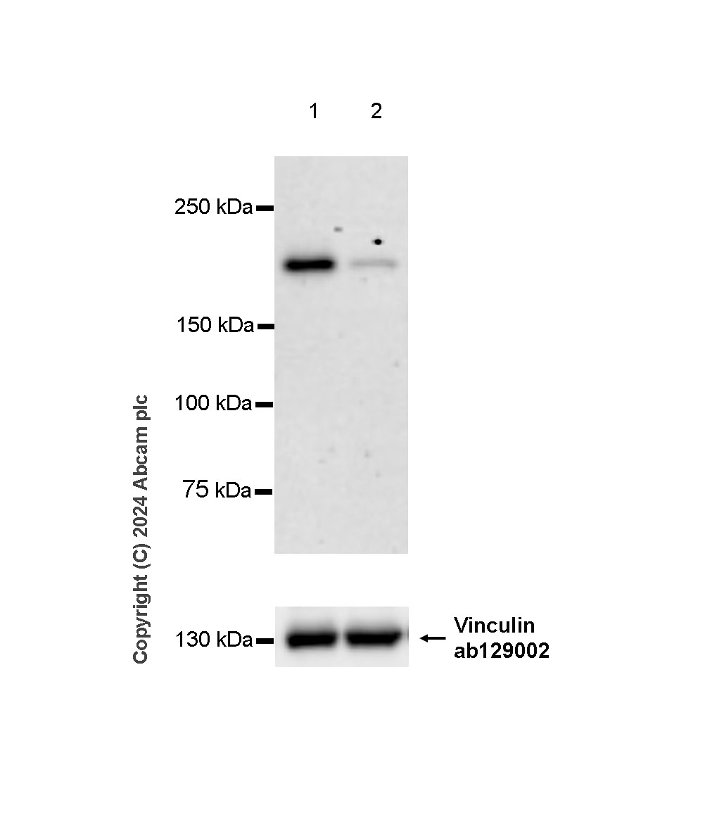 Western blot - Anti-CSB antibody [EPR27019-44] - BSA and Azide free (AB316745), expandable thumbnail