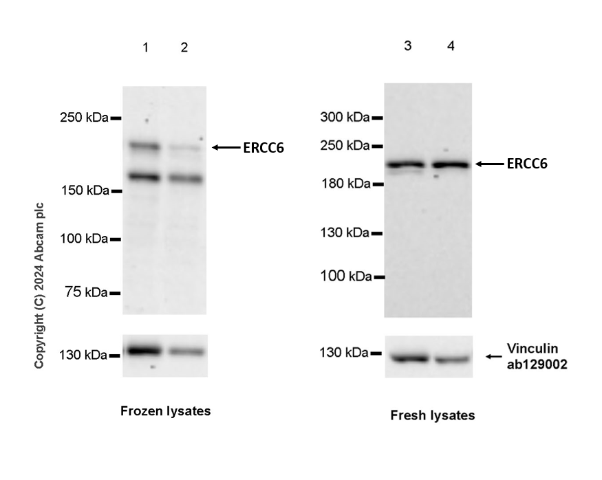 Western blot - Anti-CSB antibody [EPR27019-44] - BSA and Azide free (AB316745), expandable thumbnail
