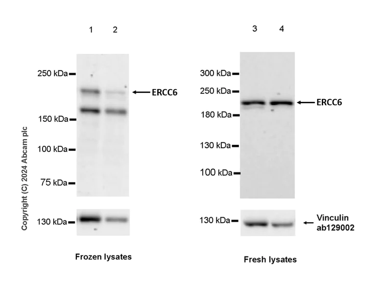 Western blot - Anti-CSB antibody [EPR27019-44] - BSA and Azide free (AB316745)