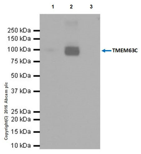 Immunoprecipitation - Anti-CSC1 antibody [EPR19814] - BSA and Azide free (AB251395), expandable thumbnail