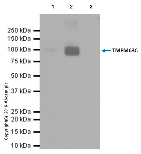 Immunoprecipitation - Anti-CSC1 antibody [EPR19814] - BSA and Azide free (AB251395)