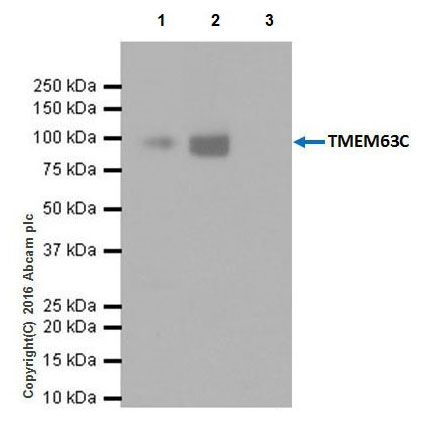 Immunoprecipitation - Anti-CSC1 antibody [EPR19814] - BSA and Azide free (AB251395), expandable thumbnail
