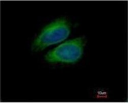Immunocytochemistry/ Immunofluorescence - Anti-CSDE1/NRU antibody (AB96124), expandable thumbnail