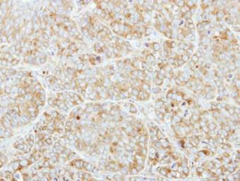 Immunohistochemistry (Formalin/PFA-fixed paraffin-embedded sections) - Anti-CSDE1/NRU antibody (AB96124), expandable thumbnail