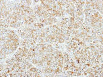 Immunohistochemistry (Formalin/PFA-fixed paraffin-embedded sections) - Anti-CSDE1/NRU antibody (AB96124)
