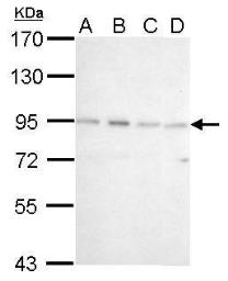 Western blot - Anti-CSDE1/NRU antibody (AB96124), expandable thumbnail