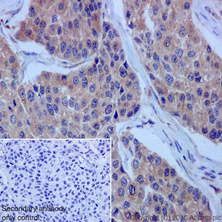 Immunohistochemistry (Formalin/PFA-fixed paraffin-embedded sections) - Anti-CSDE1/NRU antibody [EPR17414] (AB201688)