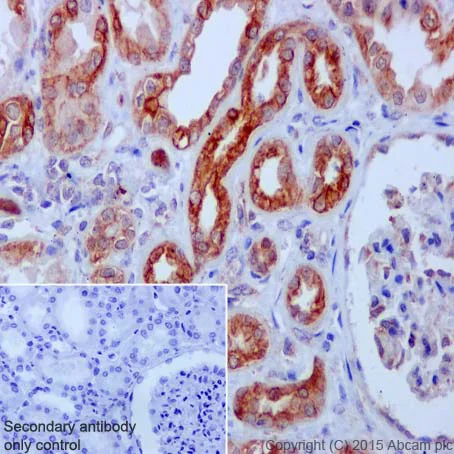 Immunohistochemistry (Formalin/PFA-fixed paraffin-embedded sections) - Anti-CSDE1/NRU antibody [EPR17414] (AB201688)