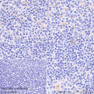 Immunohistochemistry (Formalin/PFA-fixed paraffin-embedded sections) - Anti-CSF-1-R antibody [EPR20754] - BSA and Azide free (AB231074)