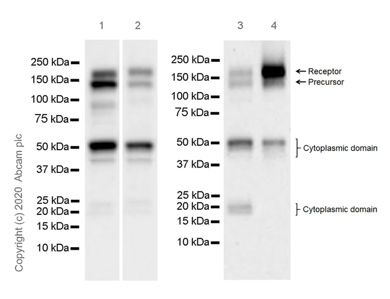 Western blot - Anti-CSF-1-R antibody [EPR23529-26] (AB254357)