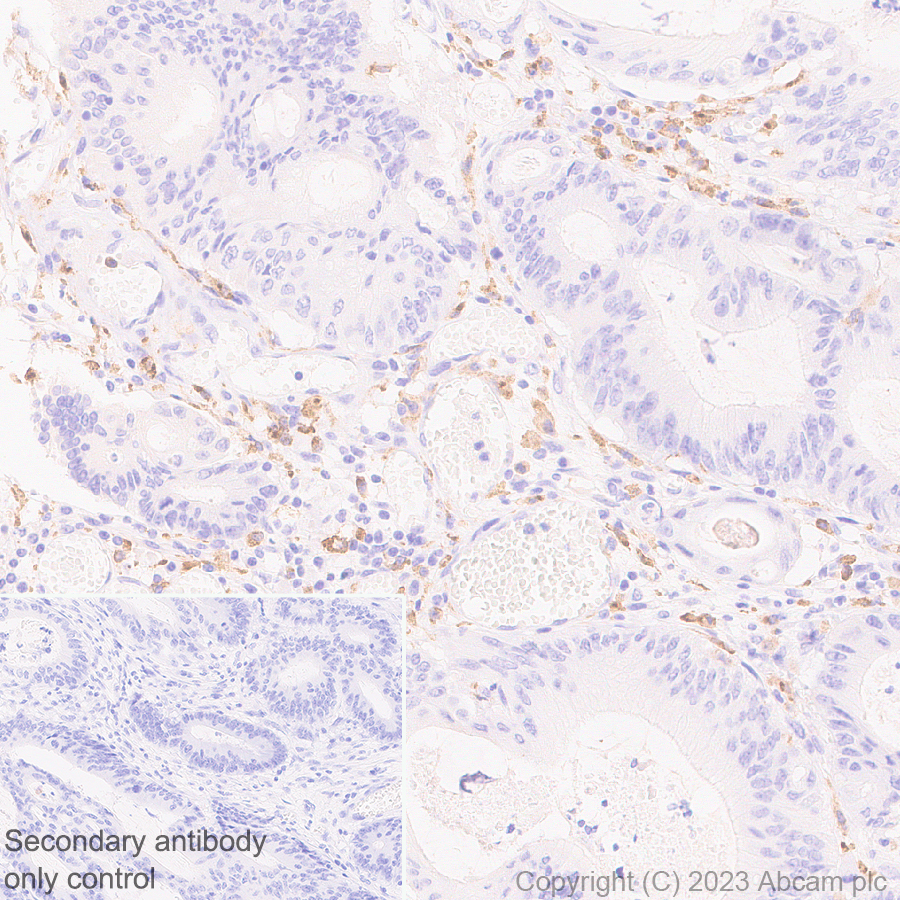 Immunohistochemistry (Formalin/PFA-fixed paraffin-embedded sections) - Anti-CSF-1-R antibody [EPR28407-22] (AB313648), expandable thumbnail