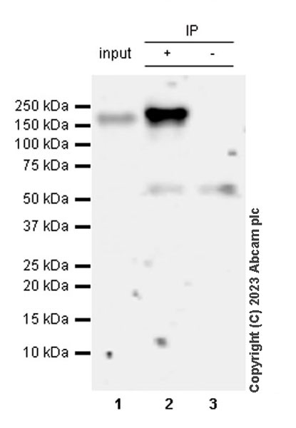 Immunoprecipitation - Anti-CSF-1-R antibody [EPR28407-22] (AB313648), expandable thumbnail