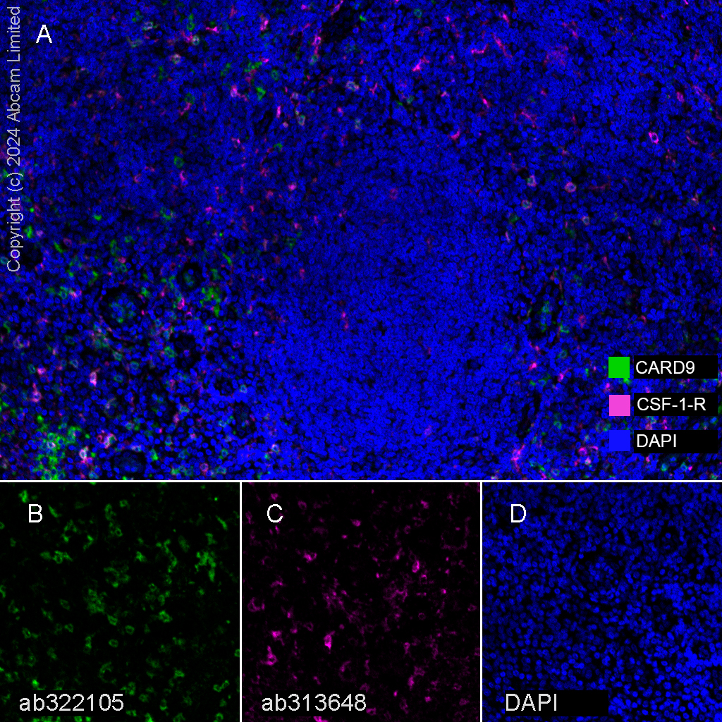 Multiplex immunohistochemistry - Anti-CSF-1-R antibody [EPR28407-22] (AB313648), expandable thumbnail