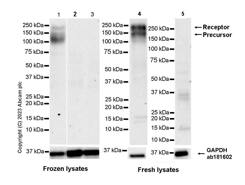 Western blot - Anti-CSF-1-R antibody [EPR28407-22] (AB313648), expandable thumbnail