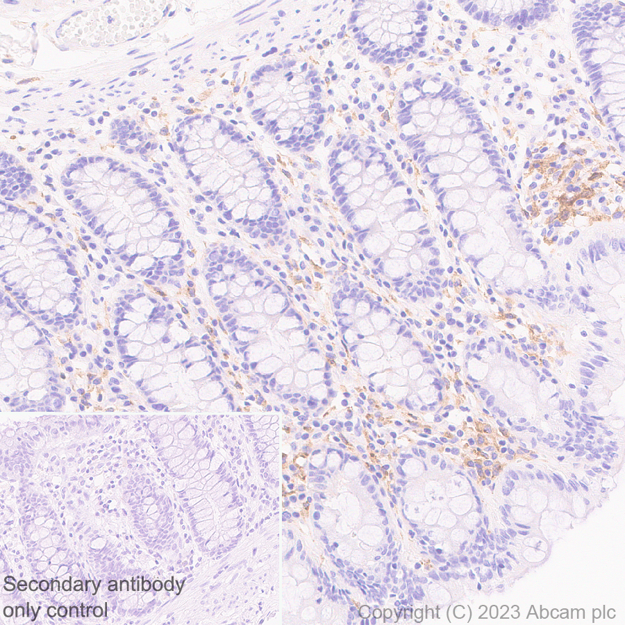 Immunohistochemistry (Formalin/PFA-fixed paraffin-embedded sections) - Anti-CSF-1-R antibody [EPR28407-22] - BSA and Azide free (ab313649), expandable thumbnail