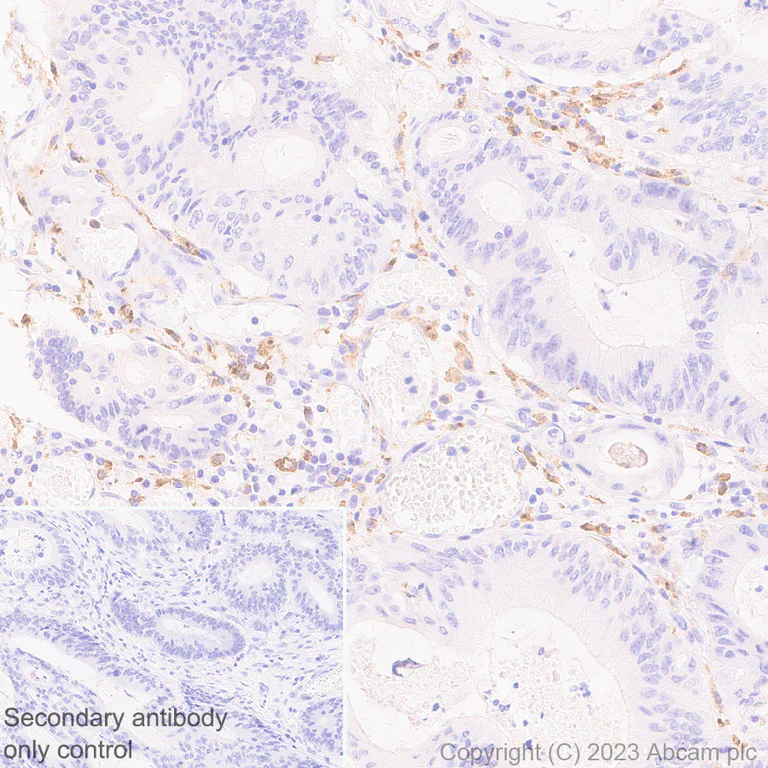 Immunohistochemistry (Formalin/PFA-fixed paraffin-embedded sections) - Anti-CSF-1-R antibody [EPR28407-22] - BSA and Azide free (AB313649)