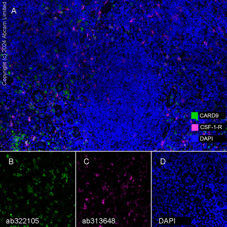 Multiplex immunohistochemistry - Anti-CSF-1-R antibody [EPR28407-22] - BSA and Azide free (AB313649)