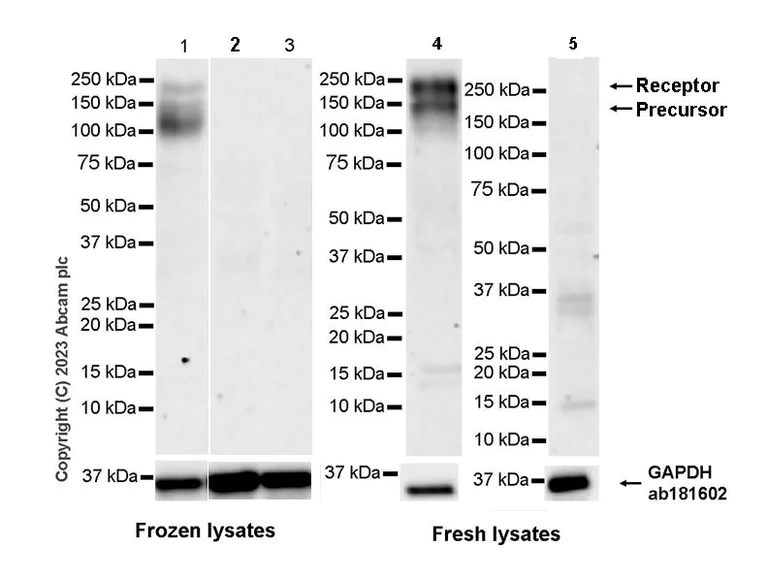 Western blot - Anti-CSF-1-R antibody [EPR28407-22] - BSA and Azide free (AB313649)