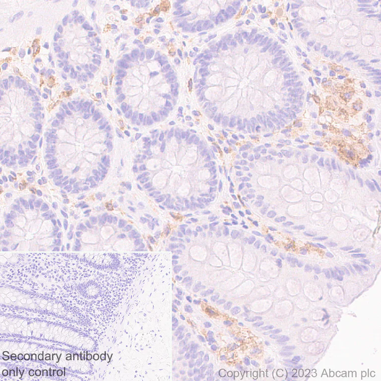 Immunohistochemistry (Formalin/PFA-fixed paraffin-embedded sections) - Anti-CSF-1-R antibody [RM2042] (AB315490)