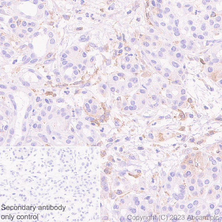 Immunohistochemistry (Formalin/PFA-fixed paraffin-embedded sections) - Anti-CSF-1-R antibody [RM2042] (AB315490)
