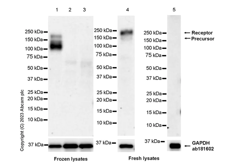 Western blot - Anti-CSF-1-R antibody [RM2042] (AB315490)