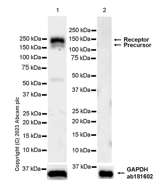 Western blot - Anti-CSF-1-R antibody [RM2042] (AB315490)