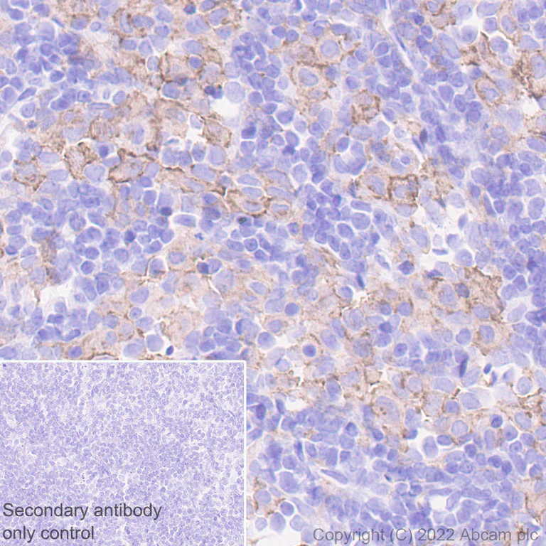 Immunohistochemistry (Formalin/PFA-fixed paraffin-embedded sections) - Anti-CSF-1-R antibody [YEYE311] (AB271294)