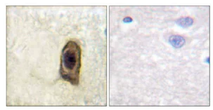 Immunohistochemistry (Formalin/PFA-fixed paraffin-embedded sections) - Anti-CSF-1-R (phospho Y561) antibody (AB192810)